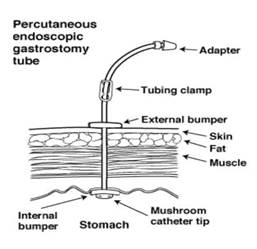 Diagram of a diagram showing the internal gastroscopy and the internal gastrointestinal tractDescription automatically generated